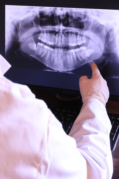 Best Emergency Dental Care for Broken or Chipped Teeth in Independence, MN